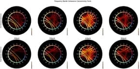 Connectivity circles illustrating the coherence between electrodes for pre-retreat and post-retreat recordings across delta, theta, alpha, and beta bands.